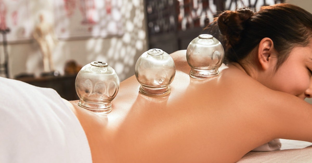 cupping therapy near me