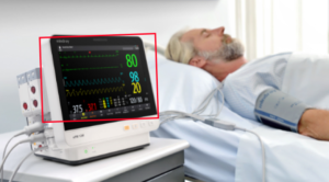 AI Video Analytics for Patient monitoring