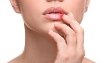 Photo of How Can A Cream For Lip Infection Help?