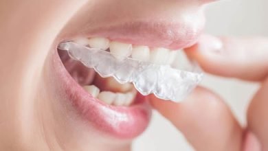 Photo of Important Facts That You Should Know About Clear Aligners