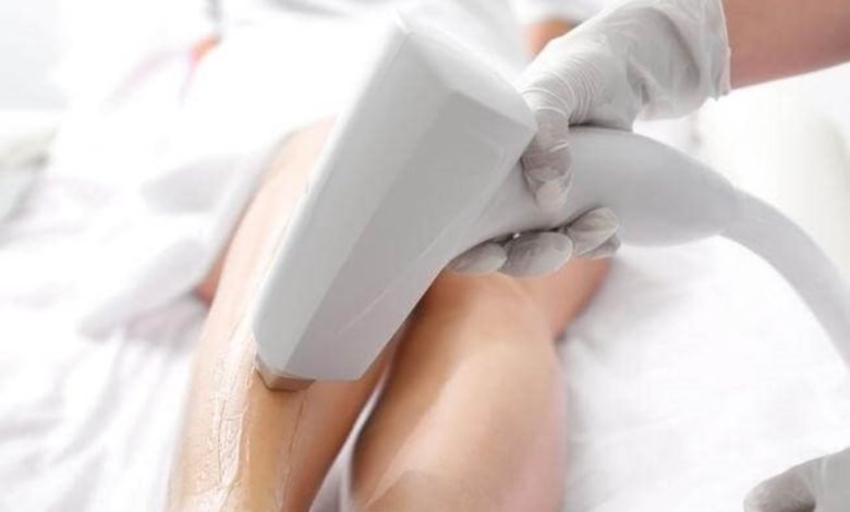 Laser Hair Removal: Is it safe or painful?