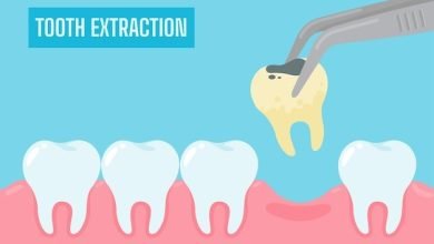 Photo of What You Need to Know About Tooth Extractions Aftercare