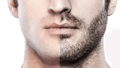 Photo of How to Get a Facial Hair Transplant in Beverly Hills